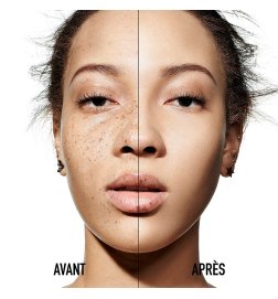 Dior Forever Skin Correct - Correcteur anticerne haute couvrance - tenue et hydratation 24h - 96% d'ingrédients d'origine nature Dior Forever Skin Correct - Correcteur anticerne haute couvrance - tenue et hydratation 24h - 96% d'ingrédients d'origine nature